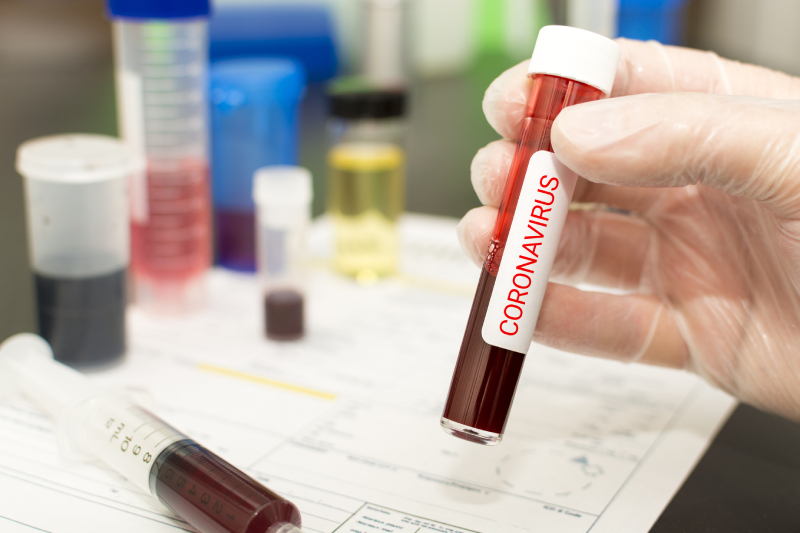 Coronavirus Coronavirus