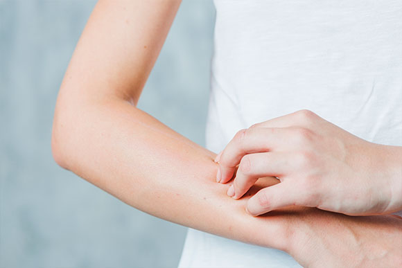 Dermatitis irritativa: cómo prevenirla en el trabajo Dermatitis irritativa: cómo prevenirla en el trabajo